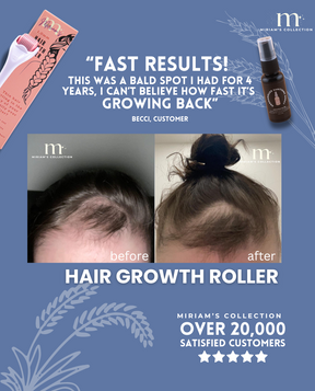 Pink Hair Growth Roller (Dermaroller 1.0mm)