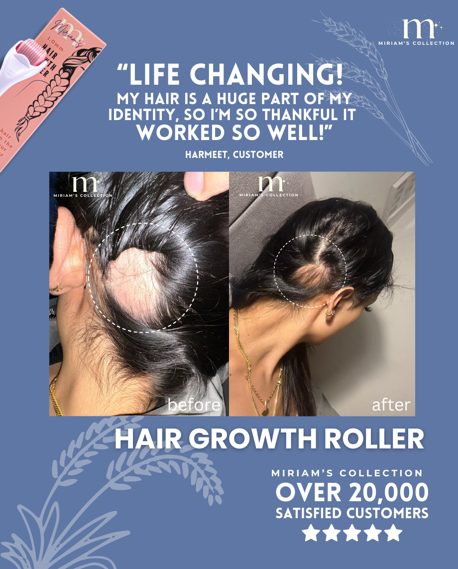 Pink Hair Growth Roller (Dermaroller 1.0mm)