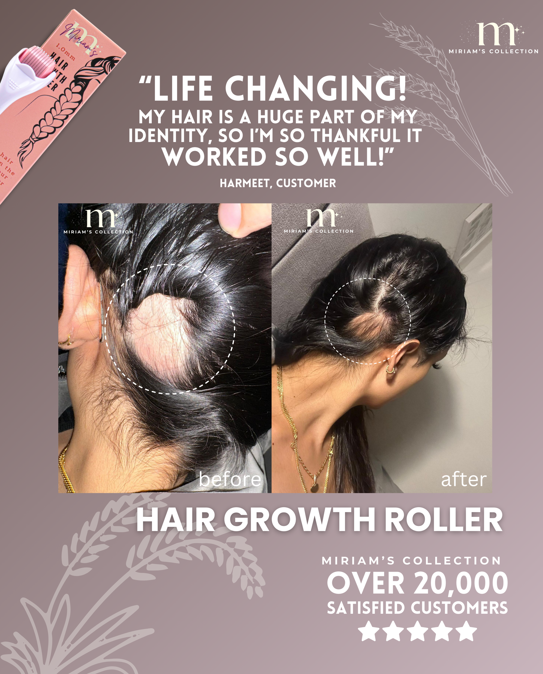 Pink Hair Growth Roller (Dermaroller 1.0mm)