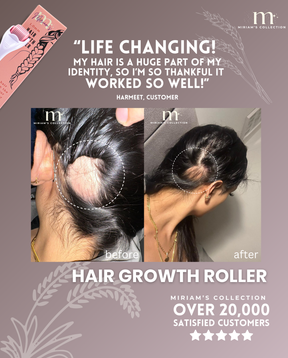 Pink Hair Growth Roller (Dermaroller 1.0mm)