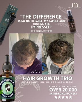 Hair Growth Trio for Men