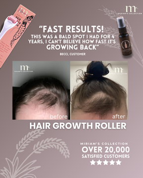 Pink Hair Growth Roller (Dermaroller 1.0mm)